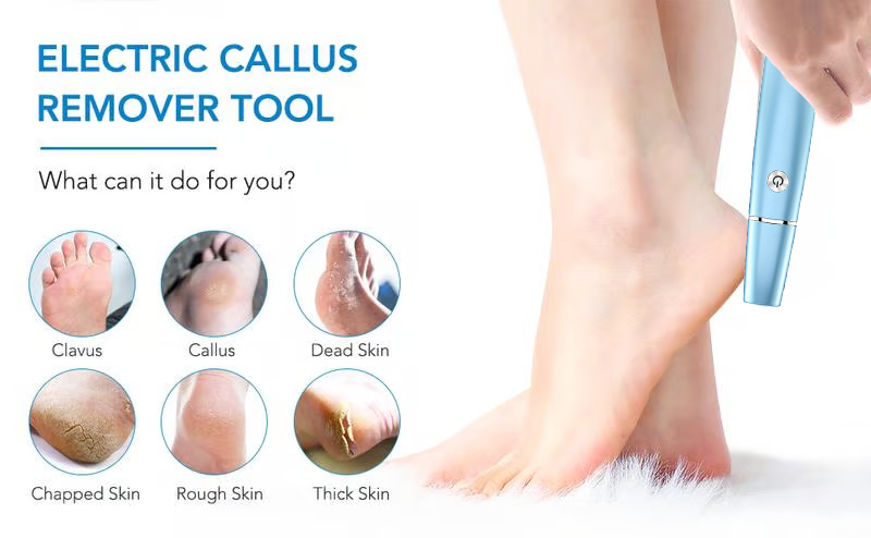 2026 Upgraded 5th Generation Electric Foot Callus Remover⚡🦶