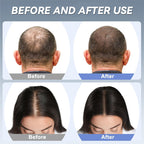 Infrared Therapy Scalp Care Cap