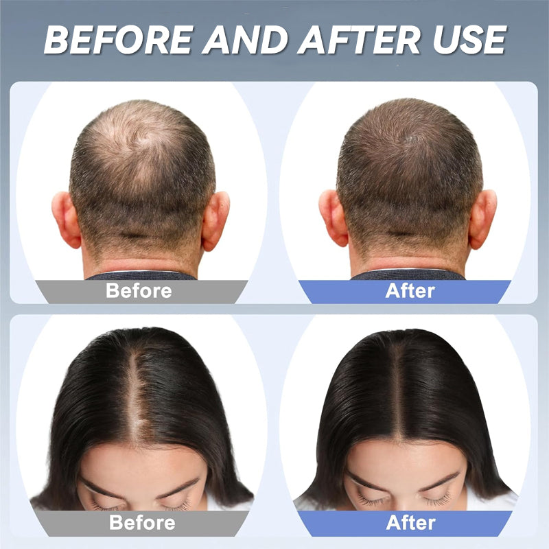 Infrared Therapy Scalp Care Cap