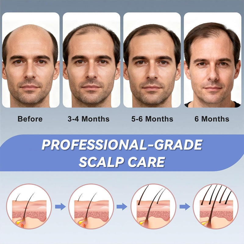 Infrared Therapy Scalp Care Cap